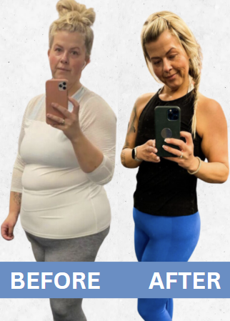 A woman's medical-program comparison, with before on the left and after on the right
